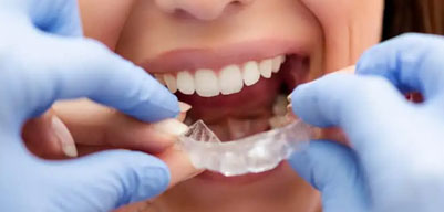 Occlusal Splints for Bruxism
