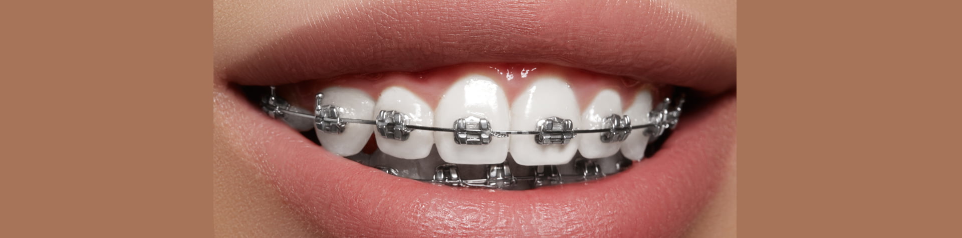 Orthodontics