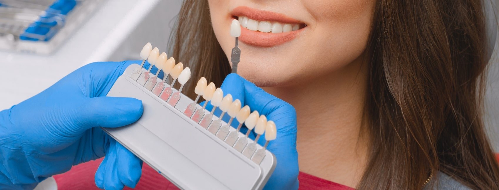 Porcelain Veneers